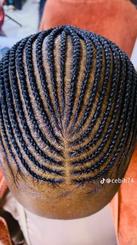 Customer photo review of Minoxidil 5% FOAM, 3 x 60ml pack