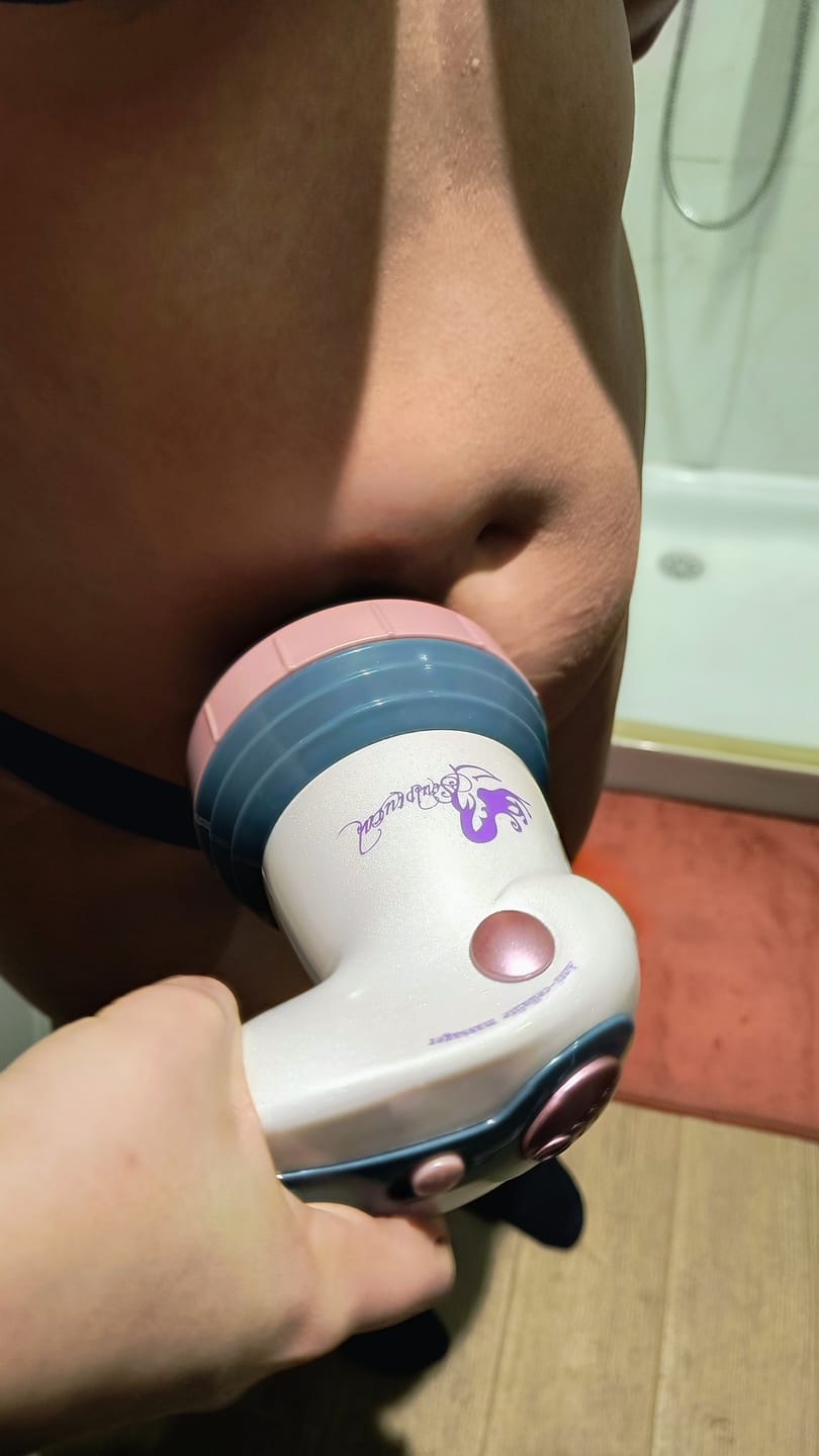 Customer photo review of Masajeador anticelulítico Cellu Clear Pro