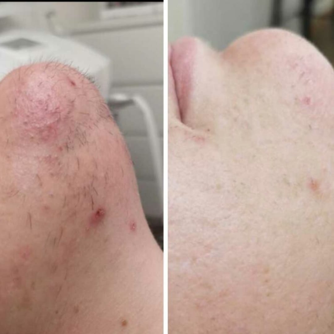 Customer photo review of AfterGlow™ Haar-Stop Serum