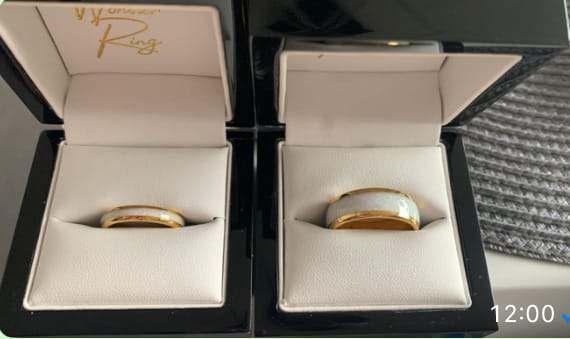 Customer photo review of The Golden White Opal Wonder Ring Set