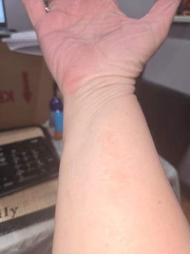 Customer photo review of [Nut-Free] Sweet Ginger Dry Oil for Sensitive Skin