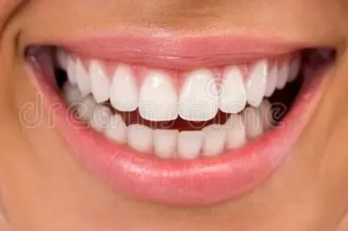 Customer photo review of 10% Nano-Hydroxyapatite Toothpaste