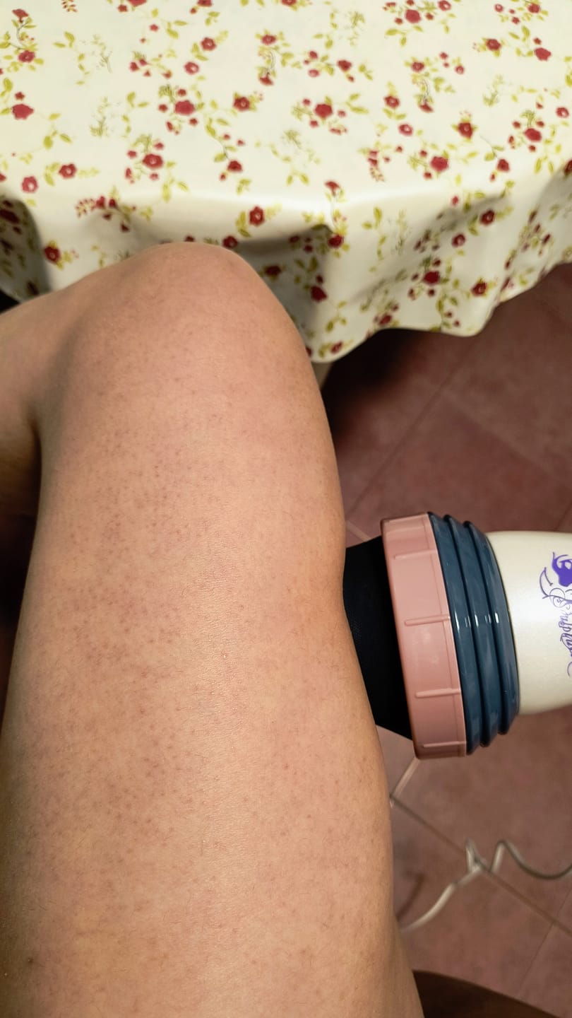 Customer photo review of Masajeador anticelulítico Cellu Clear Pro