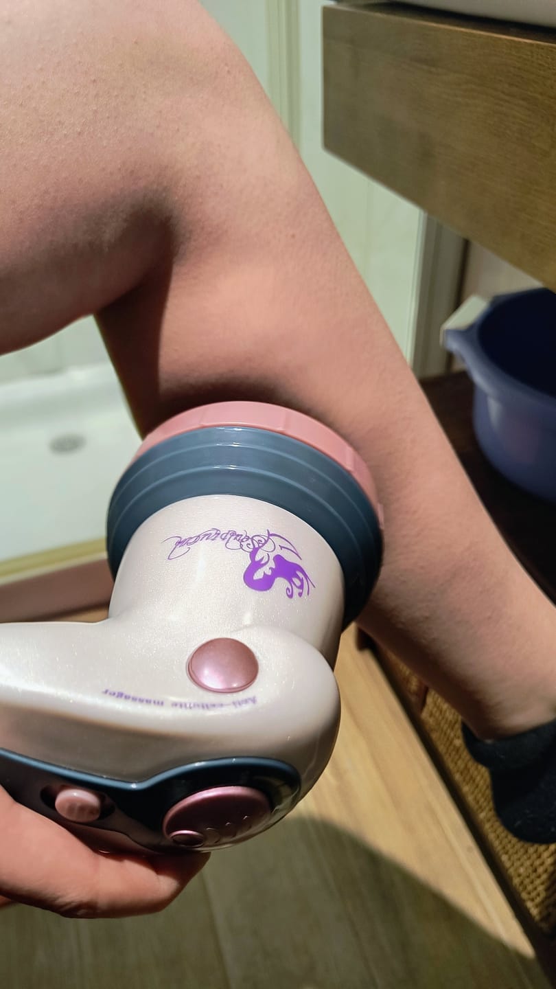 Customer photo review of Masajeador anticelulítico Cellu Clear Pro