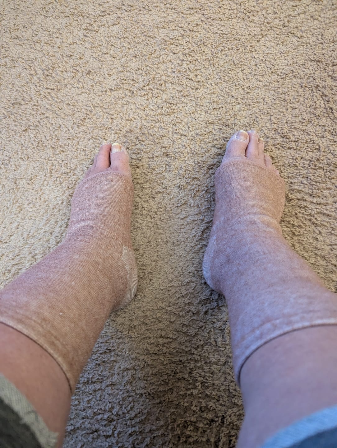 Customer photo review of Premium Anti-Fatigue Bamboo Footsleeves