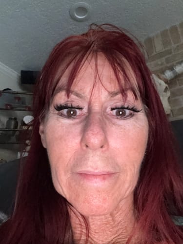 Customer's face after using The Micro Infusion System, showing smooth skin around the eyes and reduced lines around the chin.