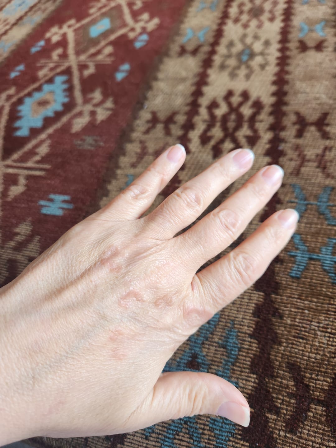 Customer photo review of LumyHealth Red & Infrared Light Therapy Glove