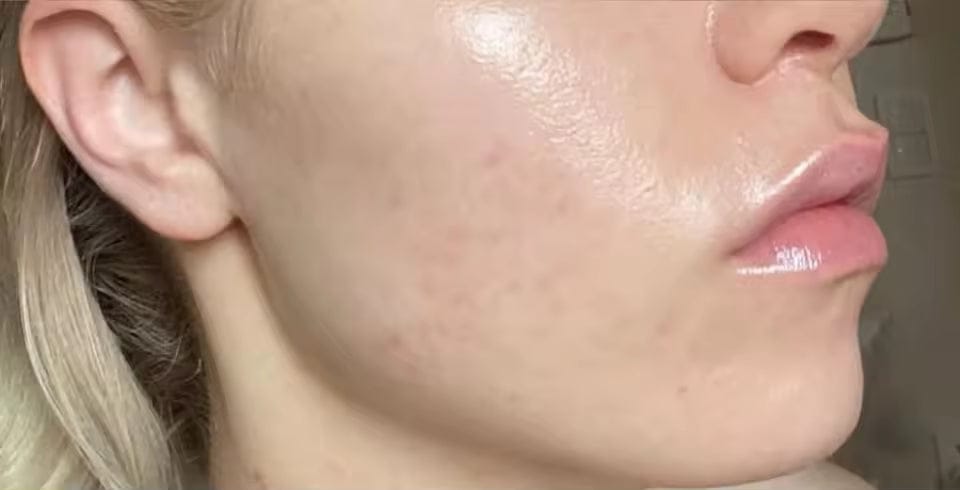 Customer photo review of Gel Mask™