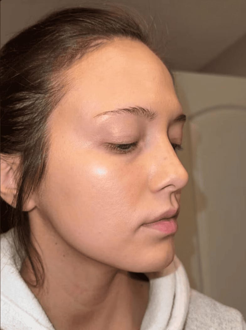 Customer photo review of Zilen Turmeric & Kojic Acid Night Wrapping Mask (75 ml)