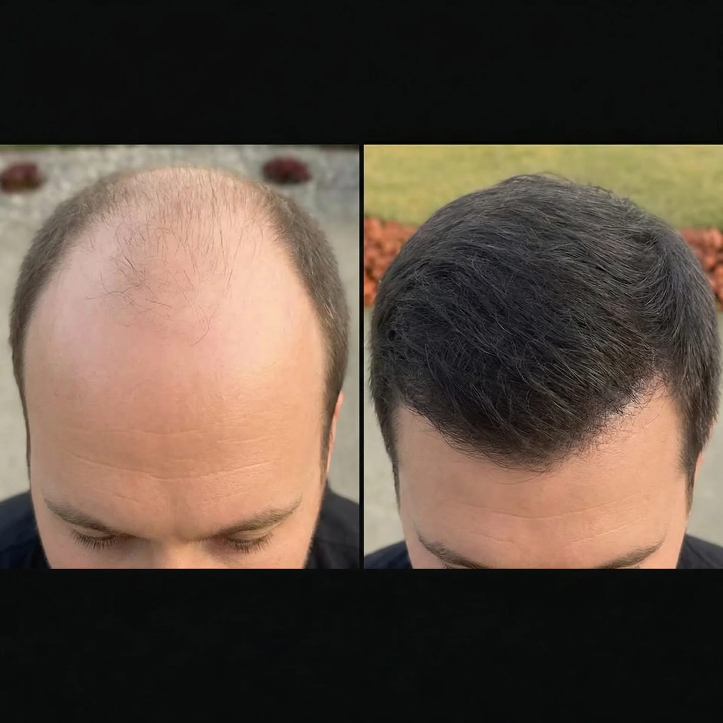 Customer photo review of SARDIAN - Szampon Aktywujący Korzenie