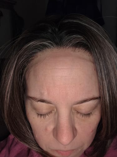 Customer photo review of JBEXTENSION 12 Inches Bob Cut Pine Cones Pre-Cut Snowflake Lace Frontlace Glueless Wig KHLOE PINE CONES【PERMATEASE】【BENDY EAR TABS】- M/L