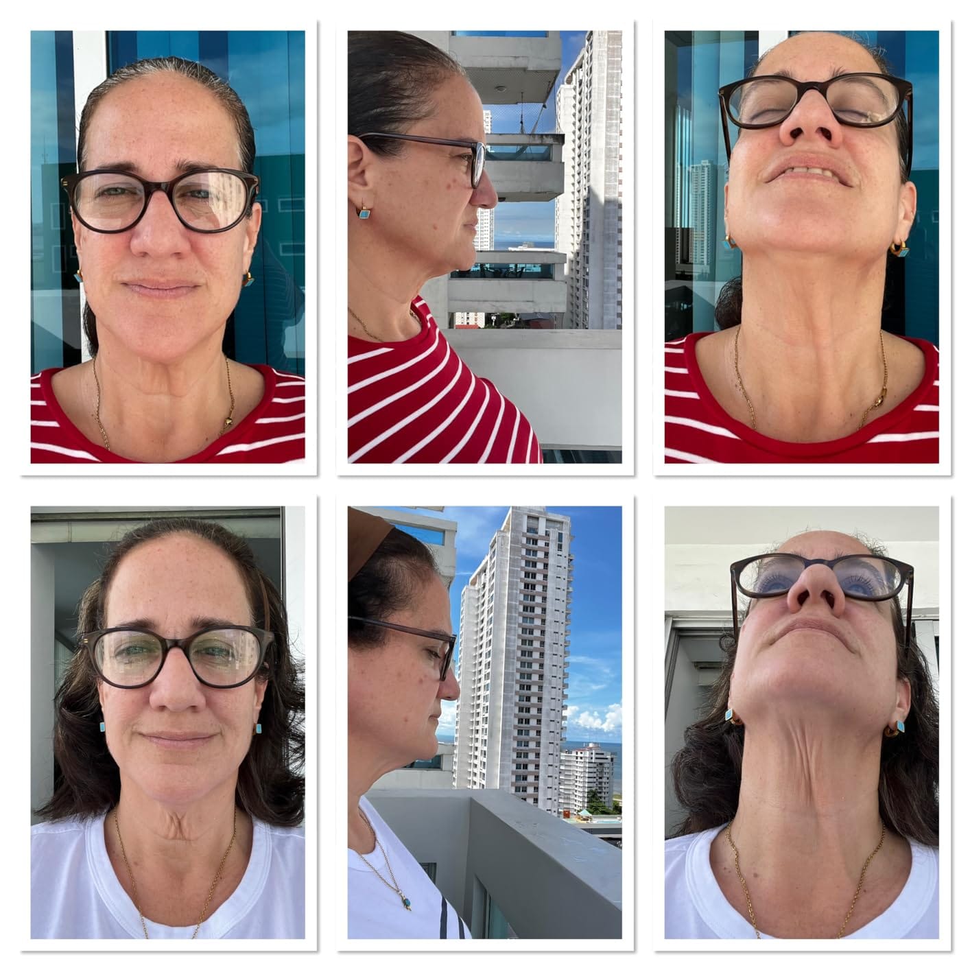 Customer photo review of Koriderm™ Time Reverse Neck Cream