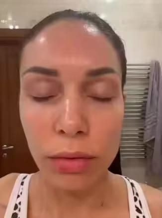 Customer photo review of Gel Mask™