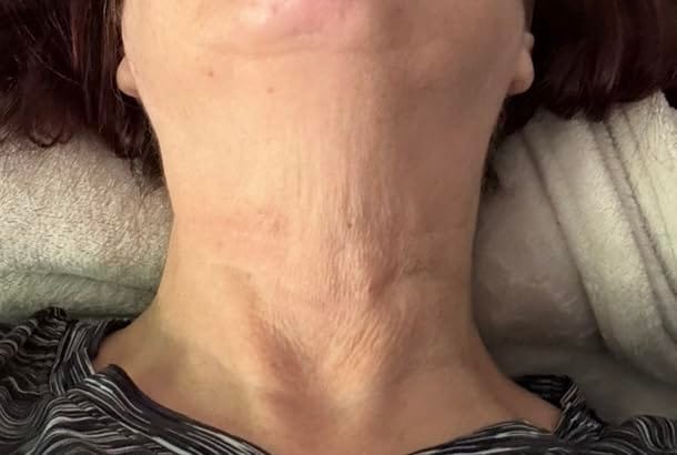 Customer photo review of Koriderm™ Time Reverse Neck Cream