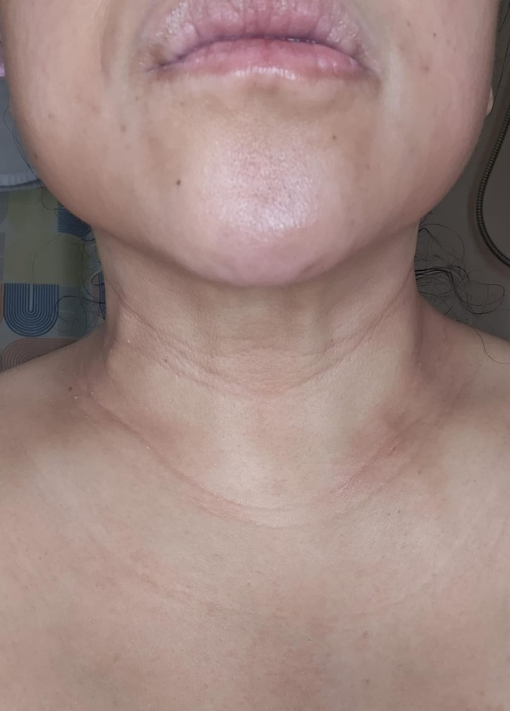 Customer photo review of Koriderm™ Time Reverse Neck Cream
