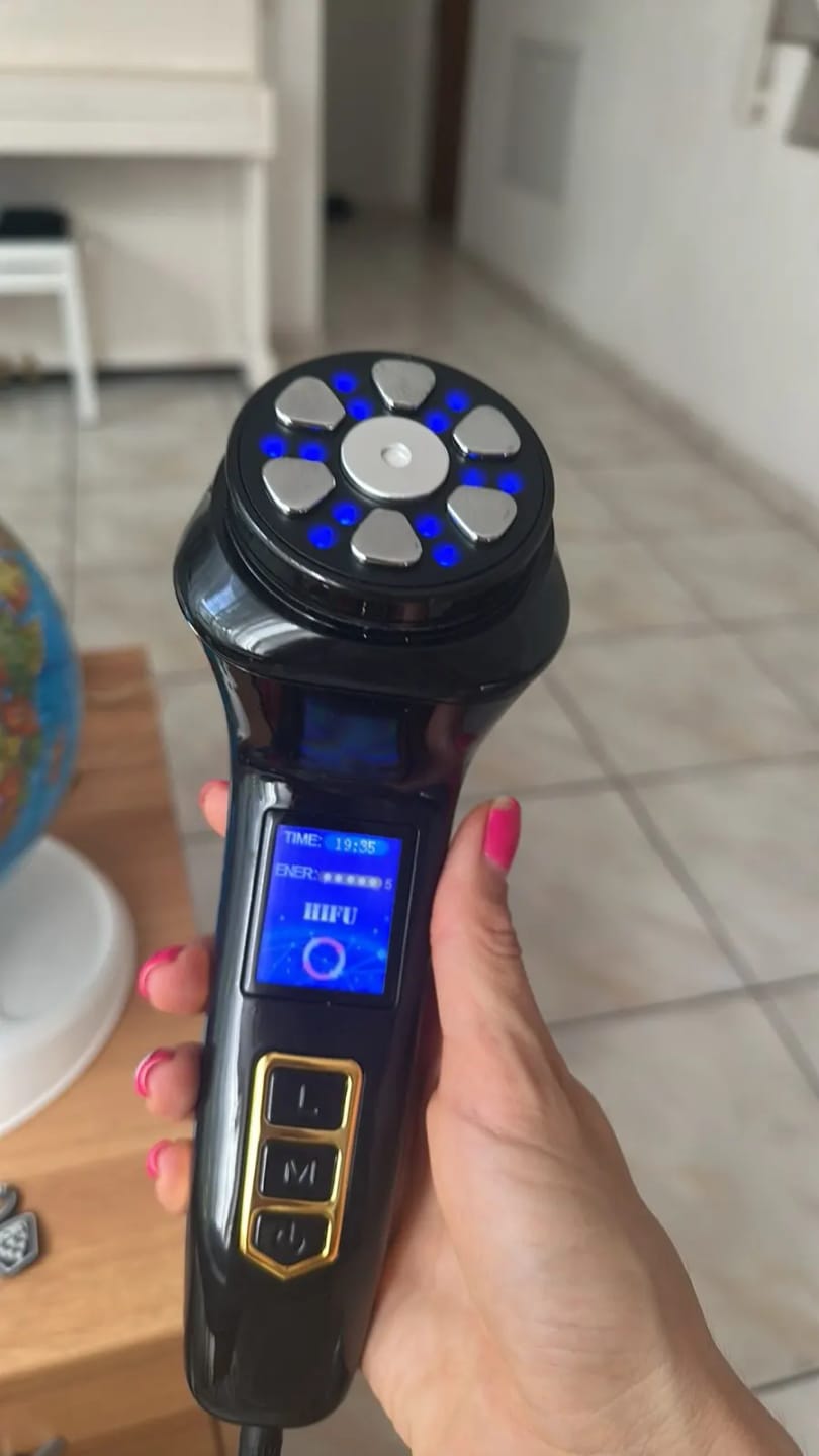 Customer photo review of Mini Portable HIFU RF Ultrasonic Anti-Wrinkle Face Lifting Device