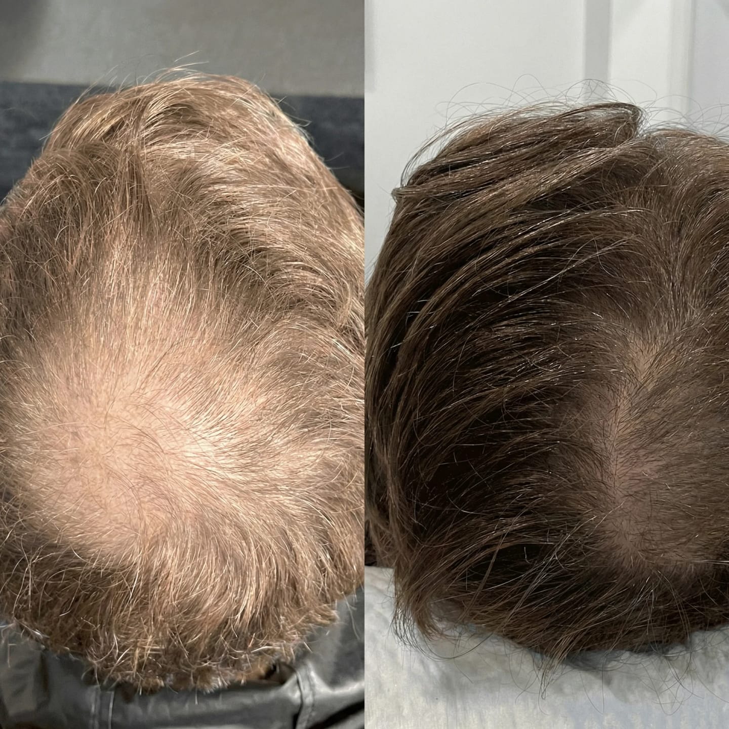 Customer photo review of SARDIAN - Szampon Aktywujący Korzenie