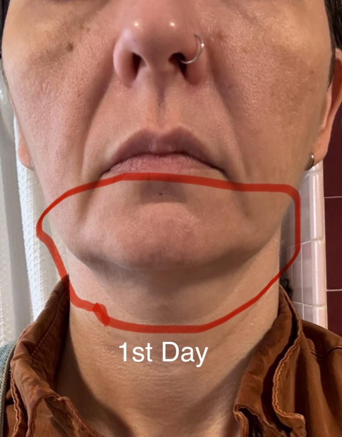 Customer photo review of Koriderm™ Time Reverse Neck Cream