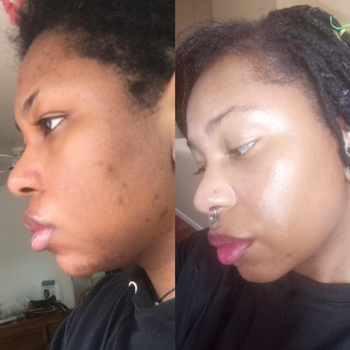 Customer photo review of Kojic Acid Turmeric Night Wrapping Mask
