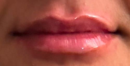 Customer photo review of 3x plumper