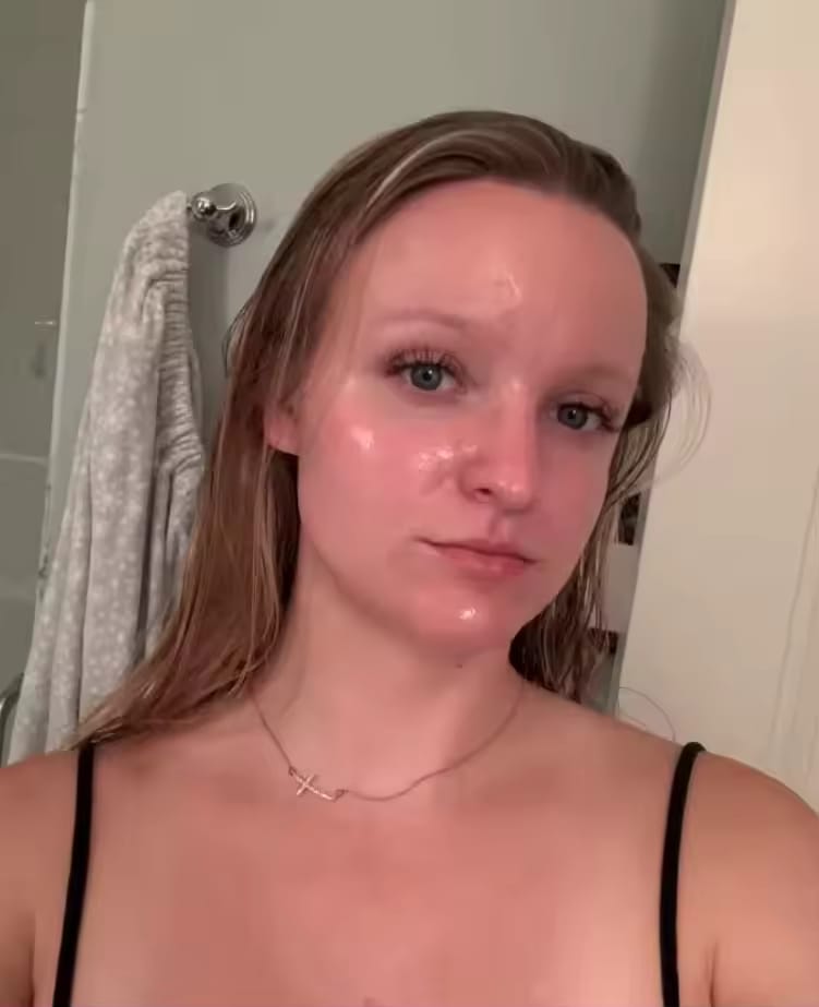 Customer photo review of Gel Mask™