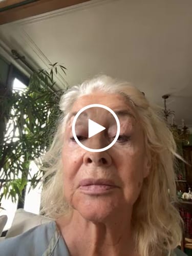Customer video review of Miyora 24K Micro-Infusion Ritual