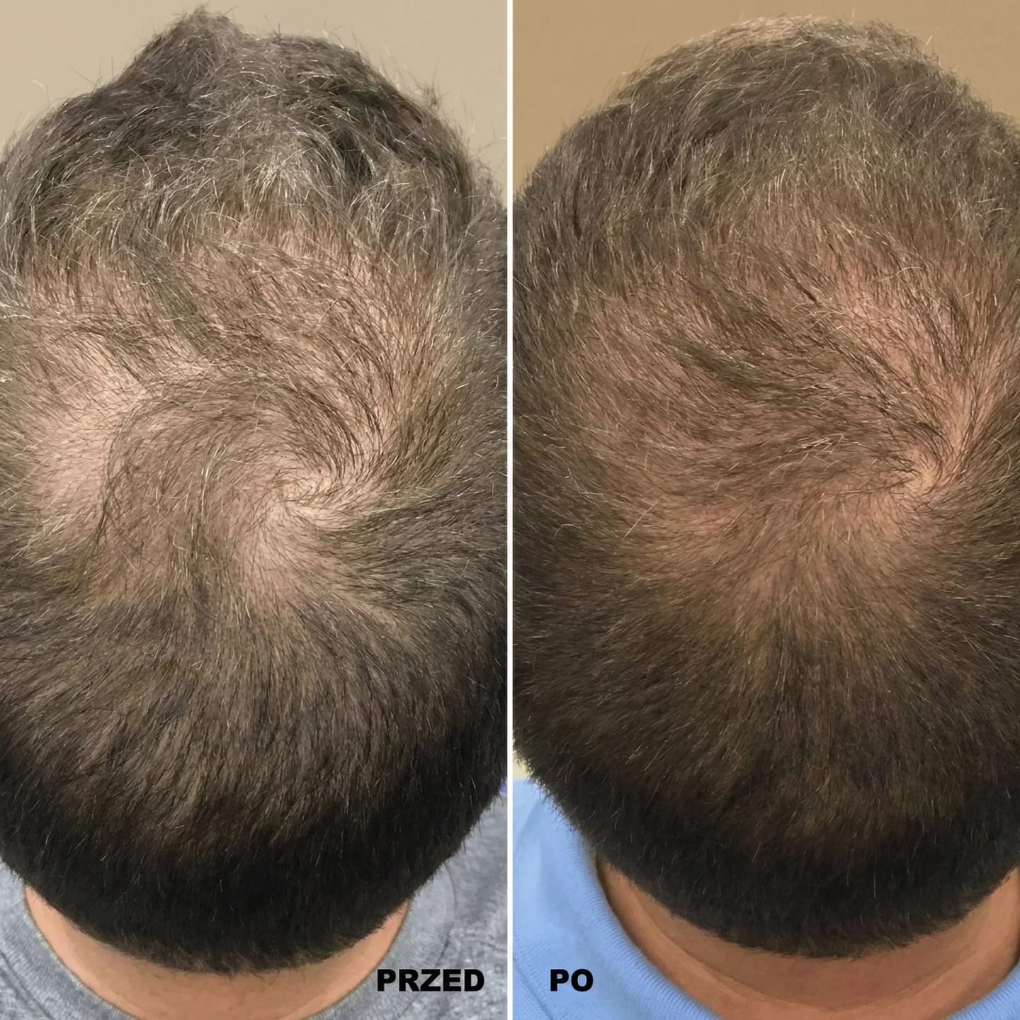Customer photo review of SARDIAN - Szampon Aktywujący Korzenie