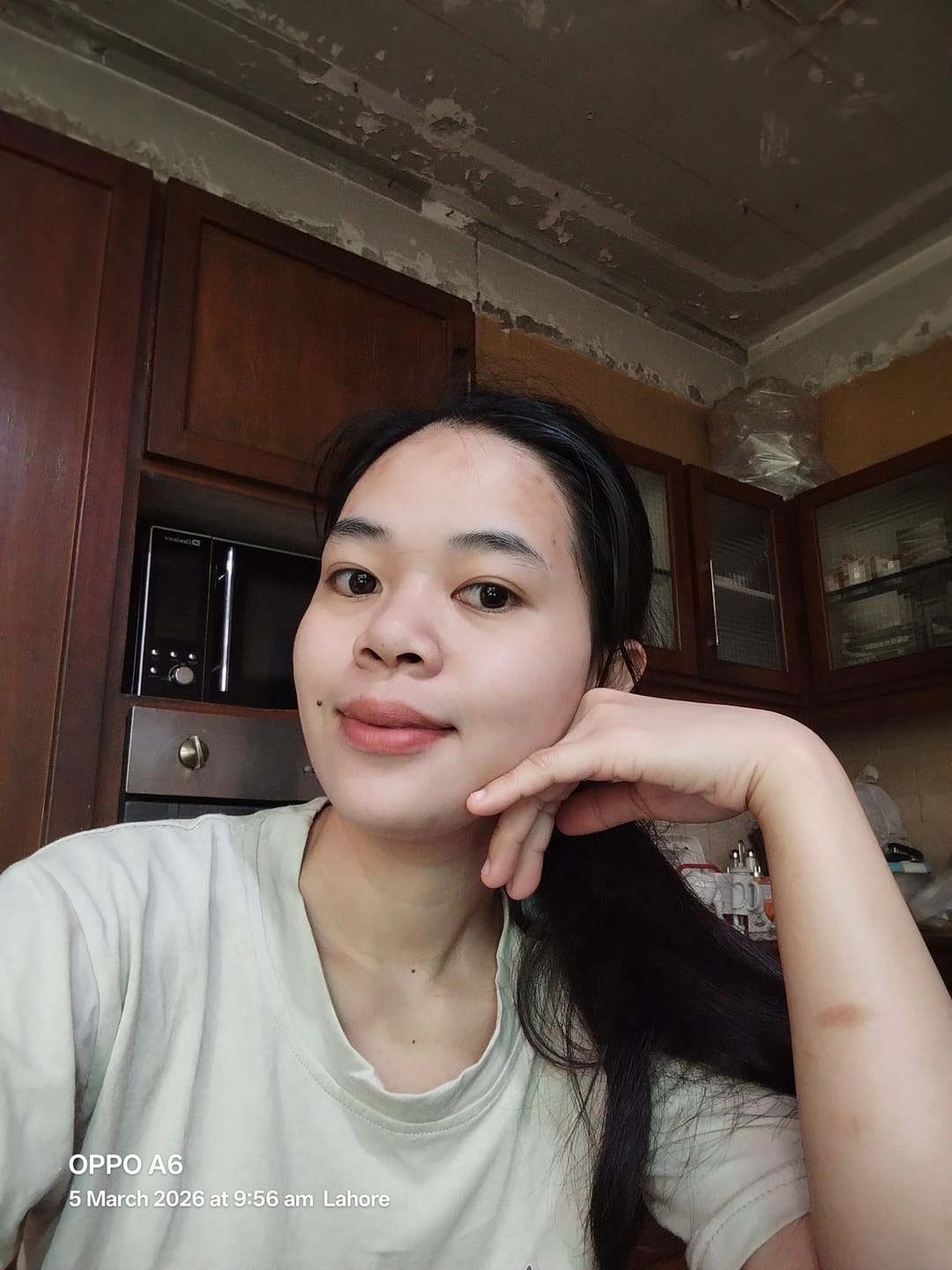 Customer photo review of Anti-Acne Cream