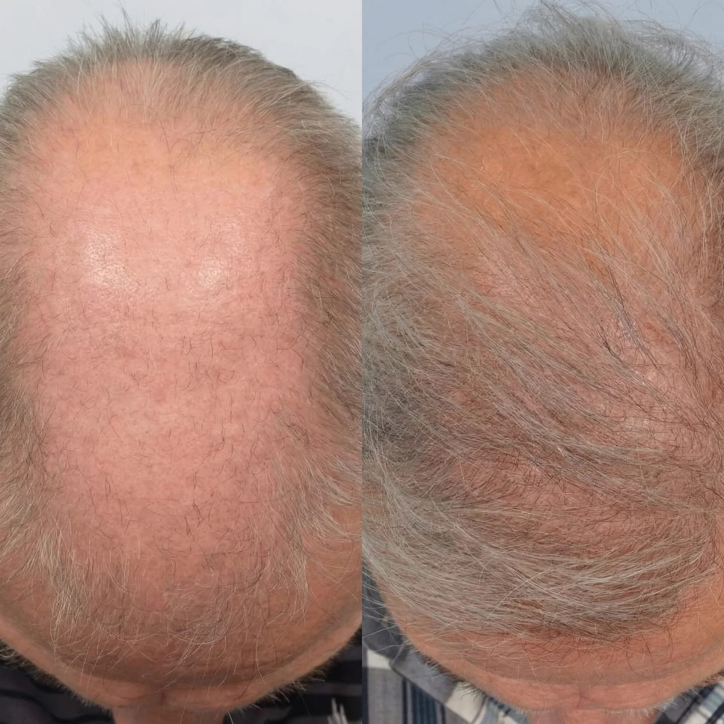 Customer photo review of SARDIAN - Szampon Aktywujący Korzenie