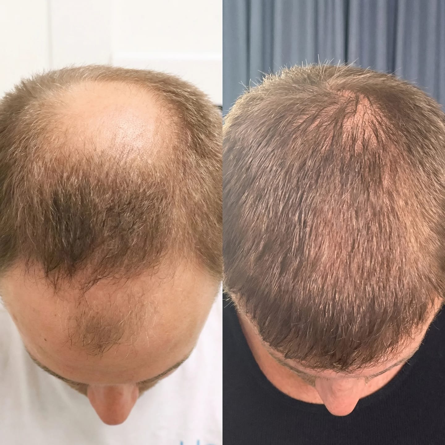 Customer photo review of SARDIAN - Szampon Aktywujący Korzenie