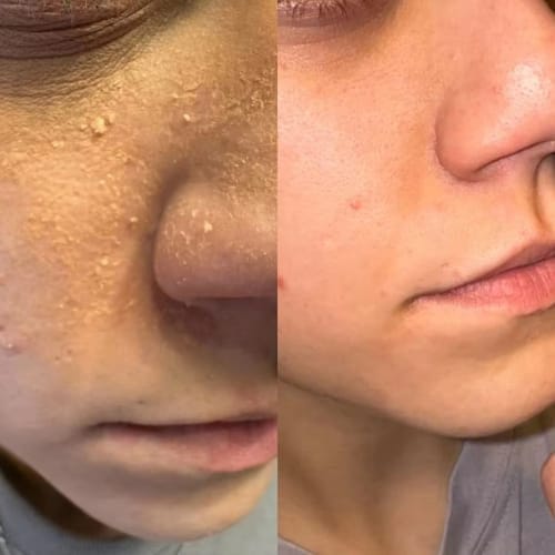 Customer photo review of Kojic Acid Turmeric Night Wrapping Mask