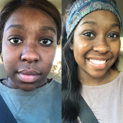 Customer photo review of Kojic Acid Turmeric Night Wrapping Mask