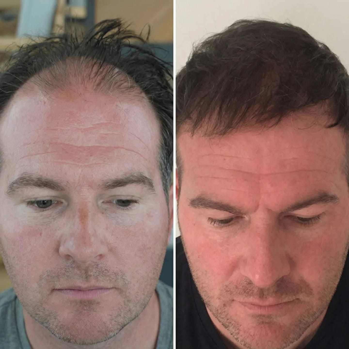 Customer photo review of SARDIAN - Szampon Aktywujący Korzenie