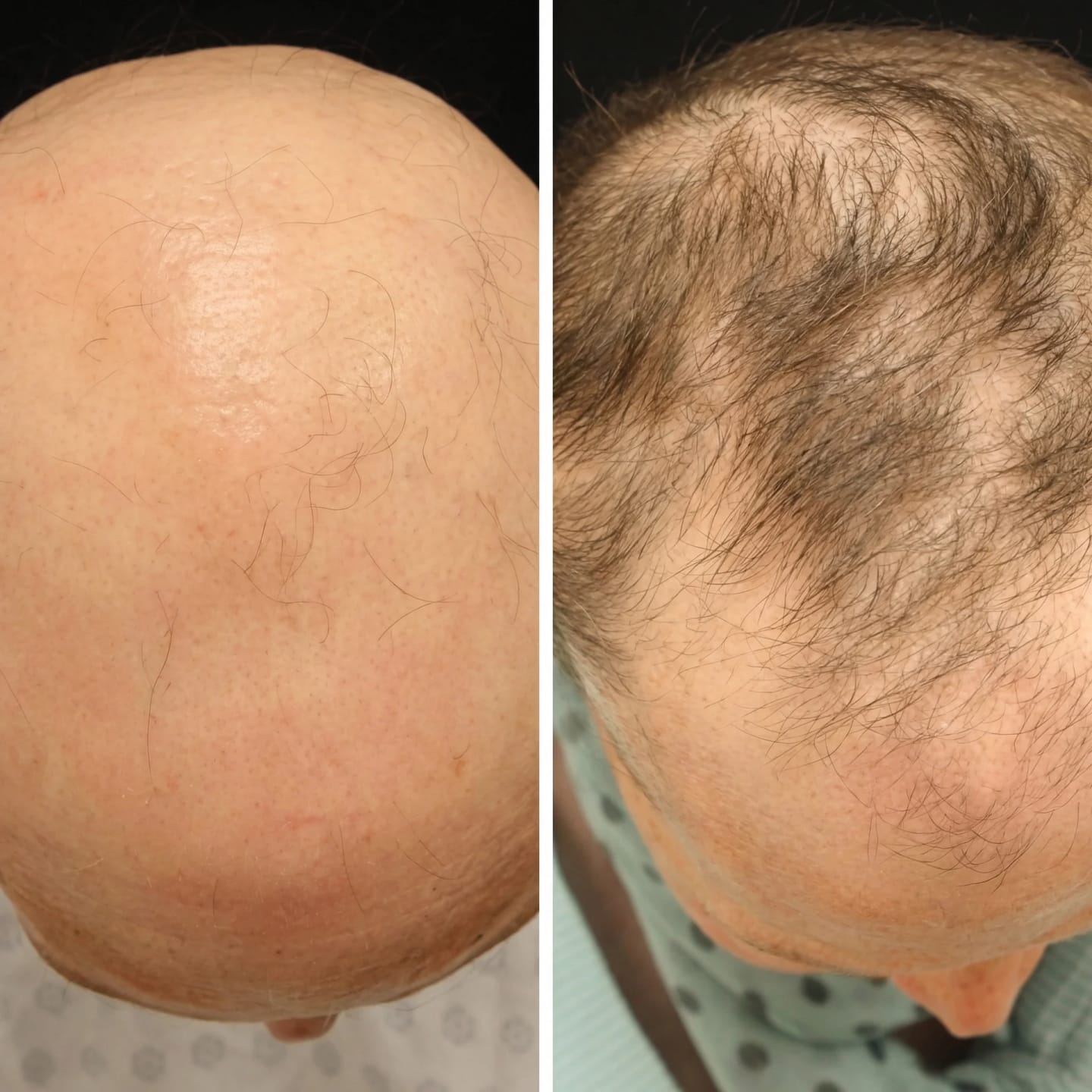 Customer photo review of SARDIAN - Szampon Aktywujący Korzenie