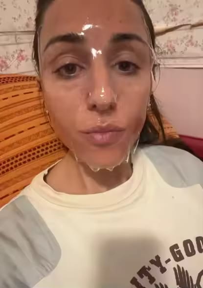Customer photo review of Maschera Rénov™