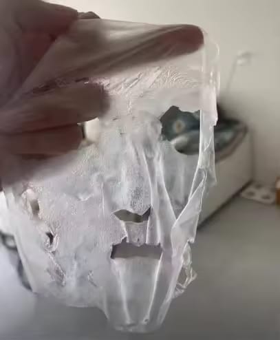 Customer photo review of Gel Mask™