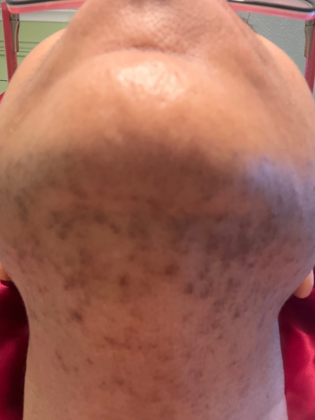 Customer photo review of Hair Reducing Fade Oil - Slows Growth, Thins, and Reduces Hair Naturally