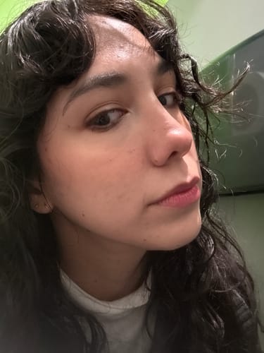 Customer photo review of Skin Blemish Balm Intensive (3 Shades)