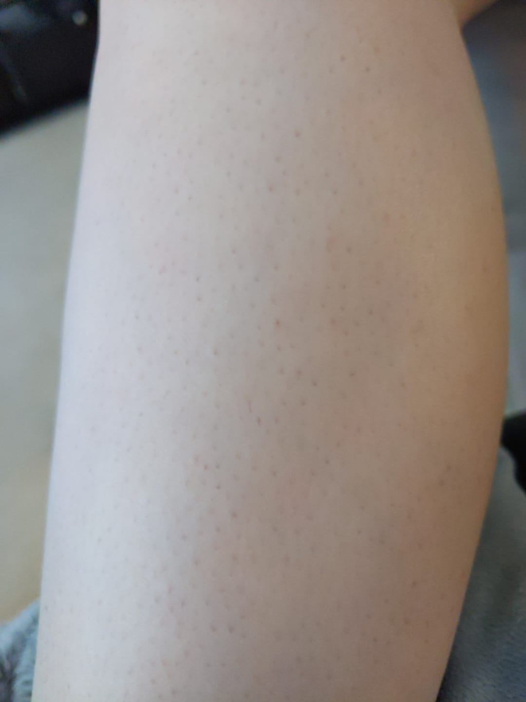 Customer photo review of Gleam Body Scrub