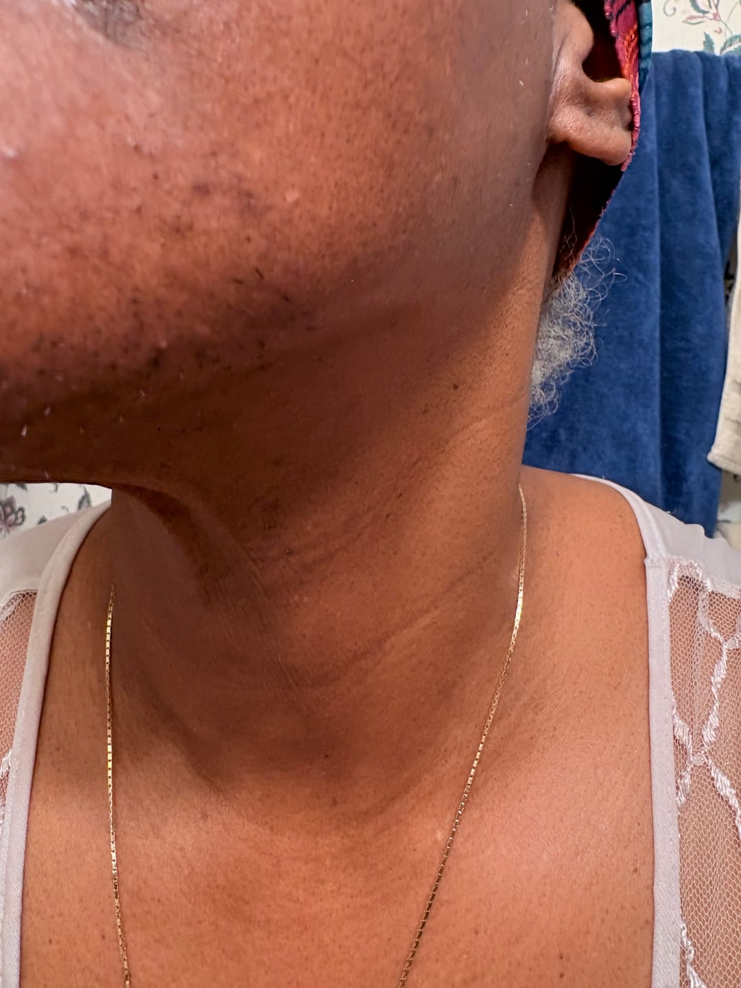 Customer photo review of Hair Reducing Fade Oil - Slows Growth, Thins, and Reduces Hair Naturally