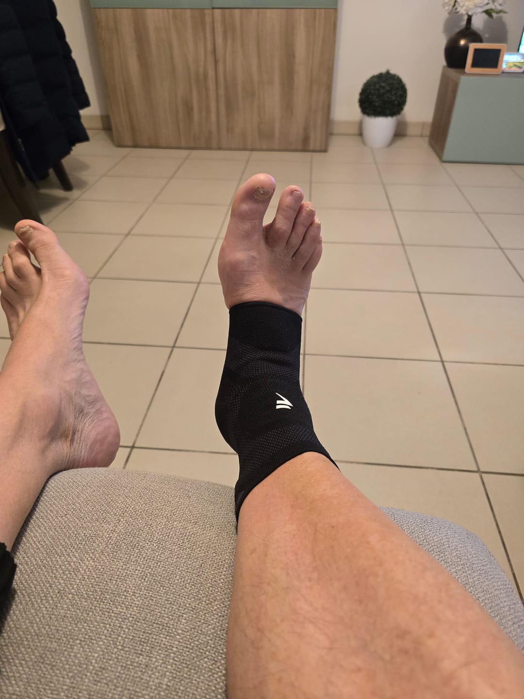 Customer photo review of Maintien de Compression pour Chevilles V3
