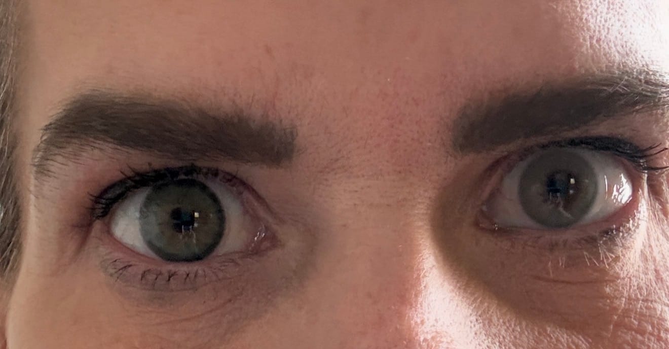 Customer photo review of Amazonia Green Prescription Colored Contact Lenses