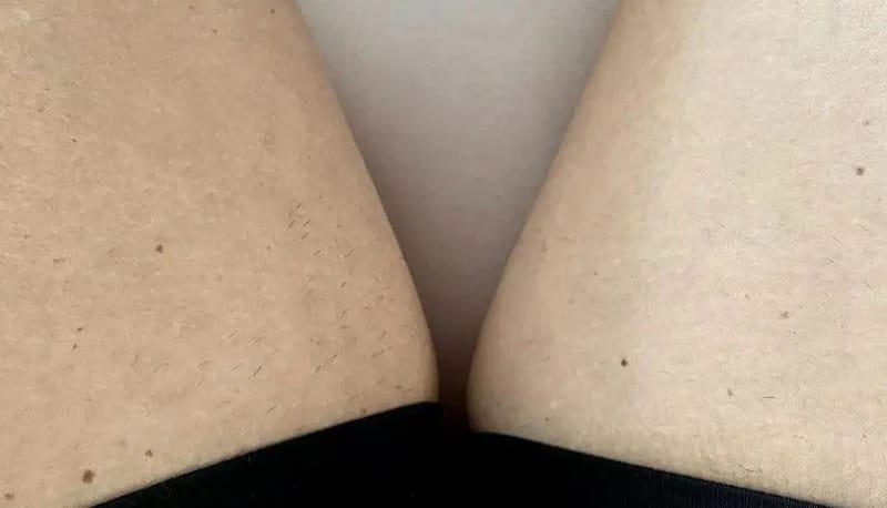 Customer photo review of Gleam Body Scrub