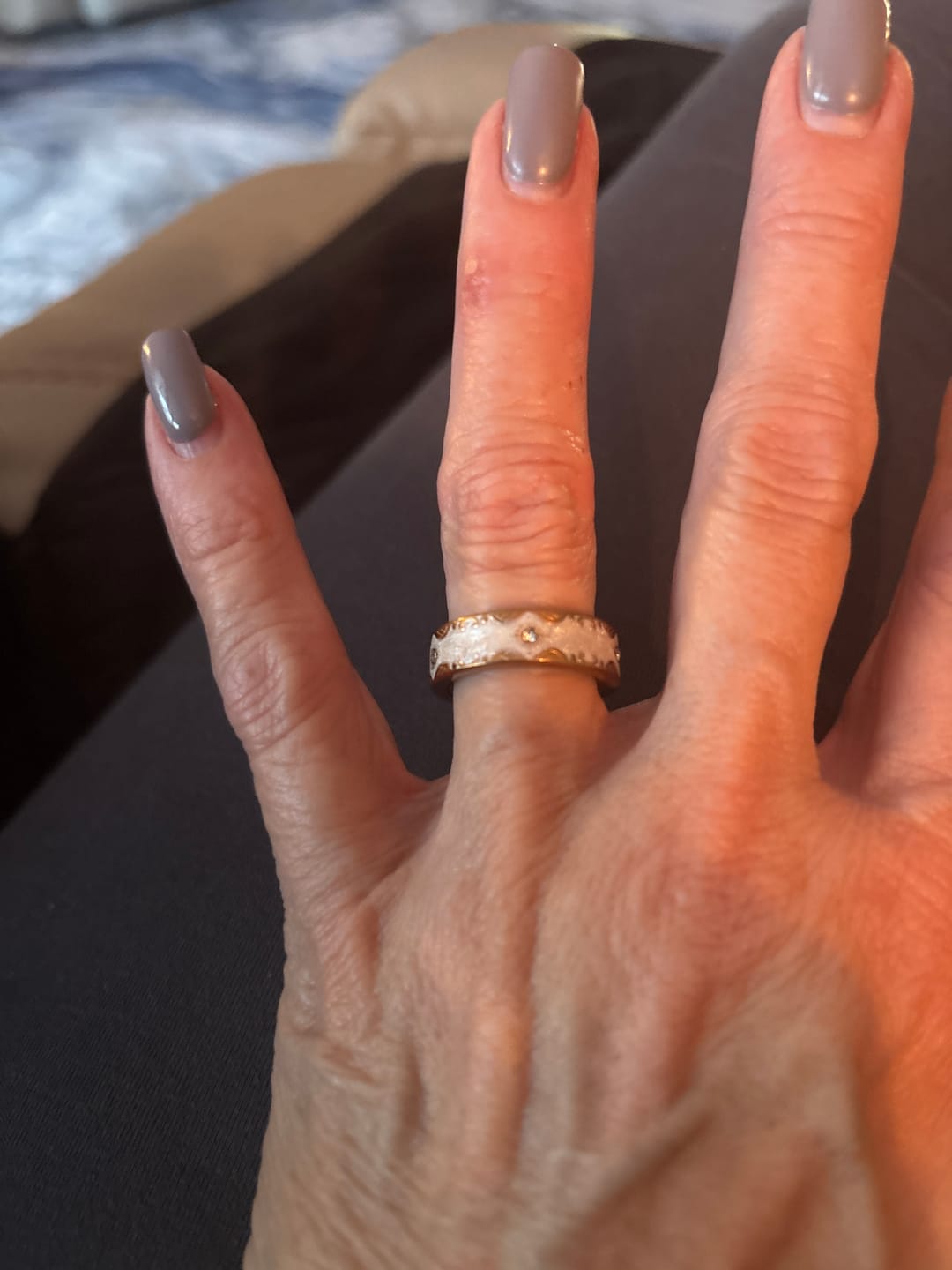 Customer photo review of Pulserive Solara Smart Ring, Sleep Tracker, Activity & Fitness Tracker, Blood Pressure& Oxygen Tracker
