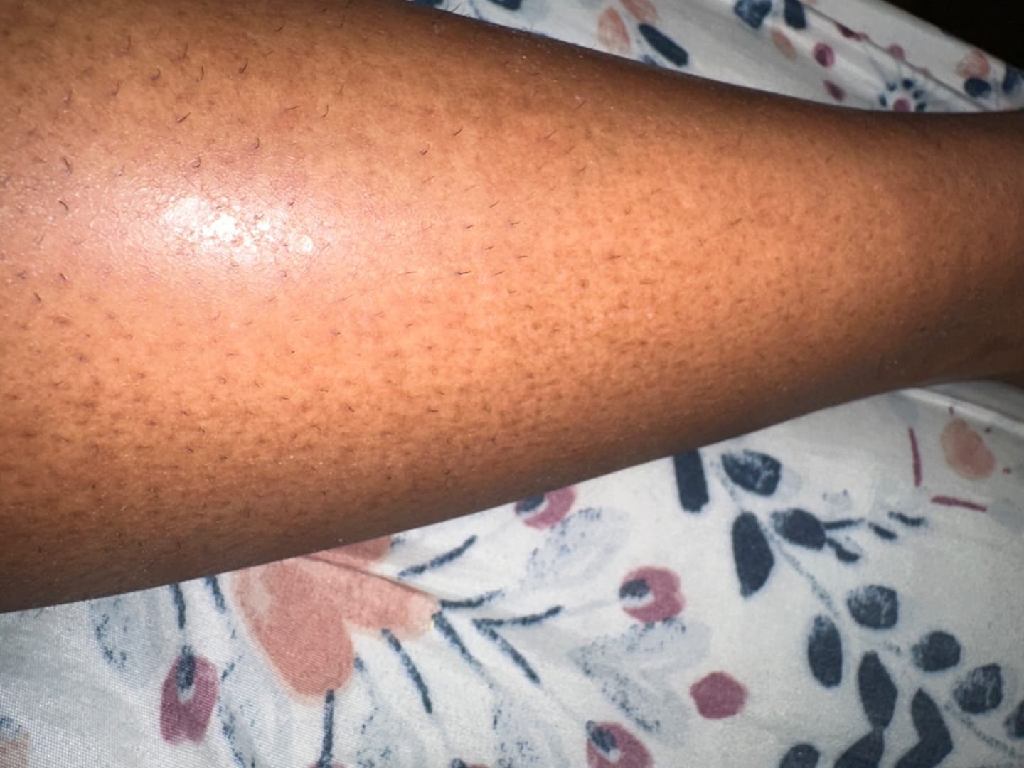 Customer photo review of Gleam Body Scrub