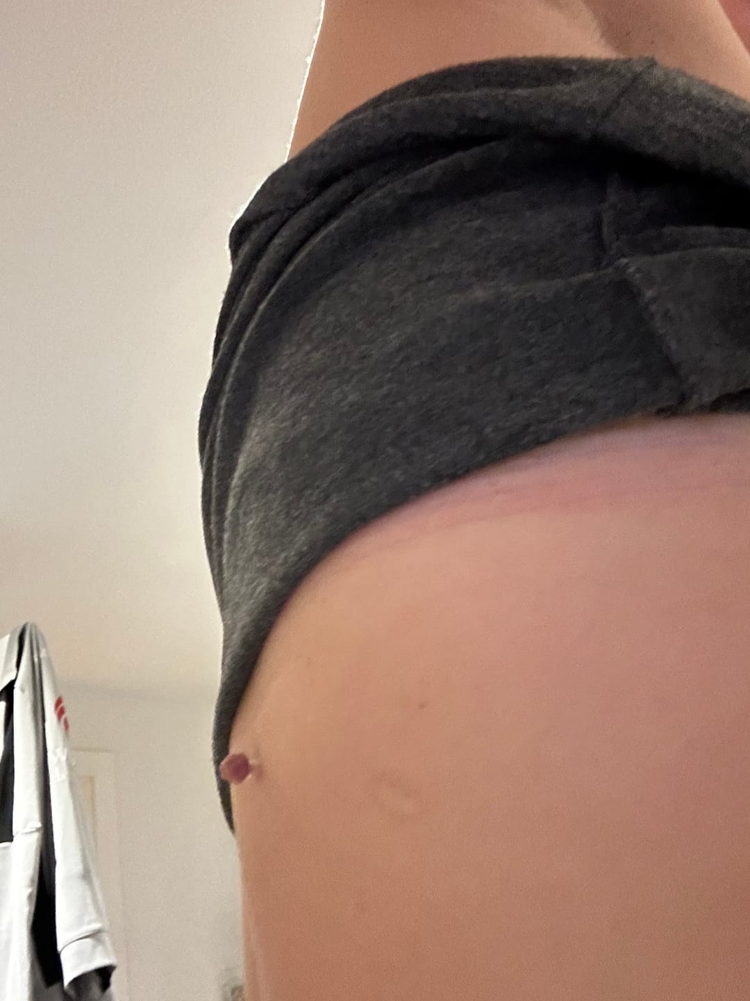 Customer photo review of Alcura Aftercare Patches