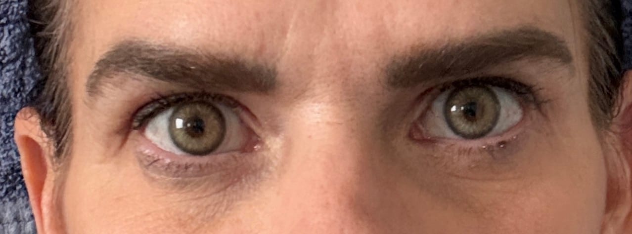 Customer photo review of Flora Green Prescription Colored Contact Lenses
