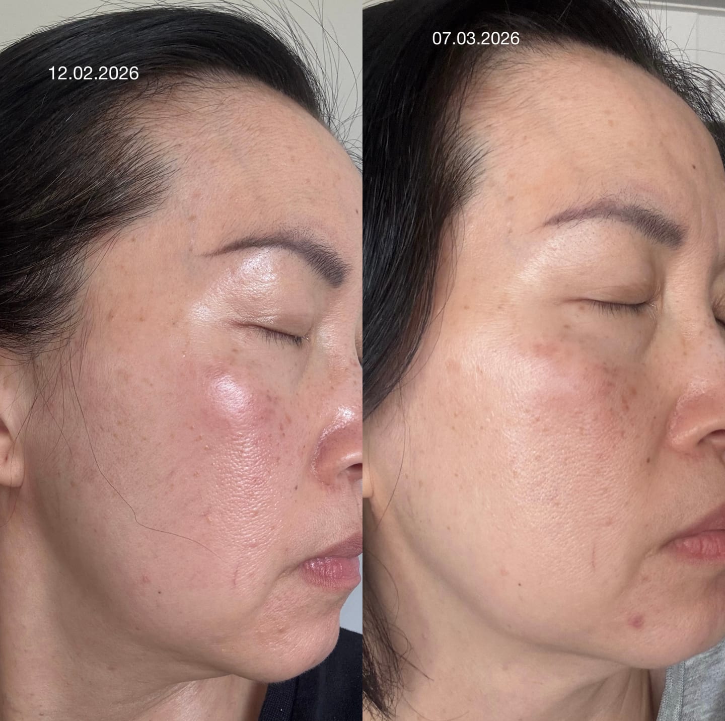 Customer photo review of BEAUTY GLOW DUO - SUPER STICK + MOISTURISER