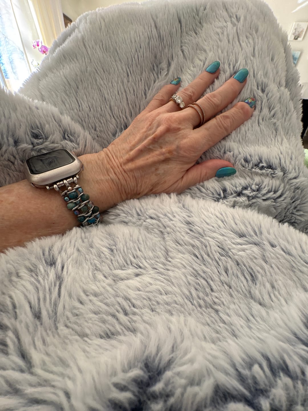 Customer photo review of Apatite Azure Braided Apple Watch Strap
