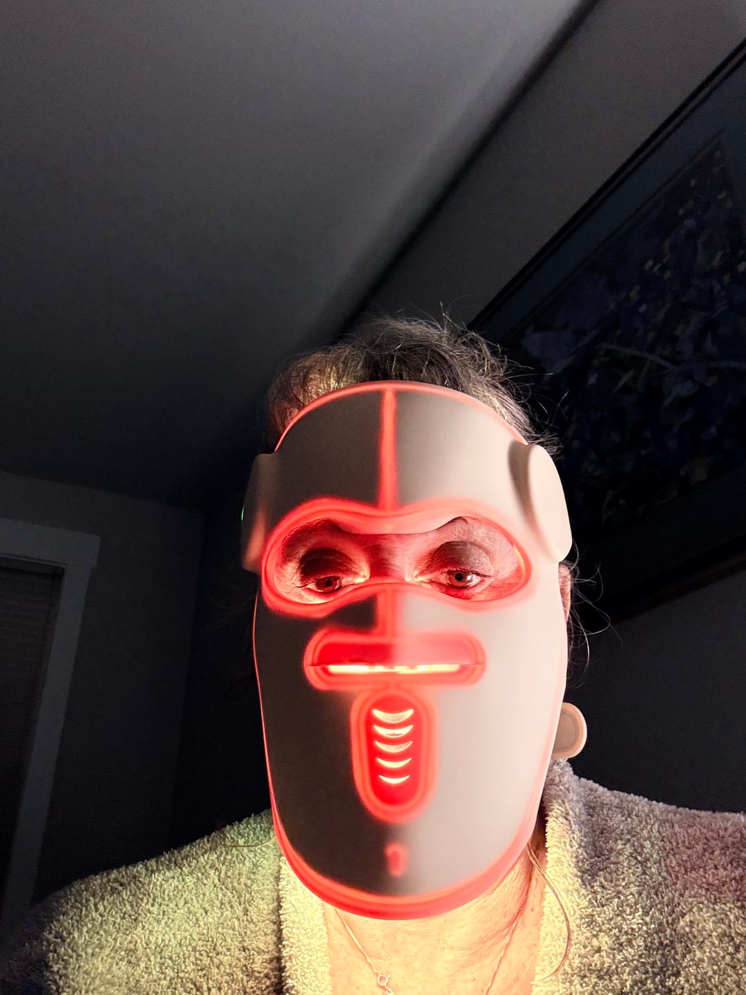 Customer photo review of Hatch Halo™ Dermatologist Grade 3-in-1 Light Therapy Mask